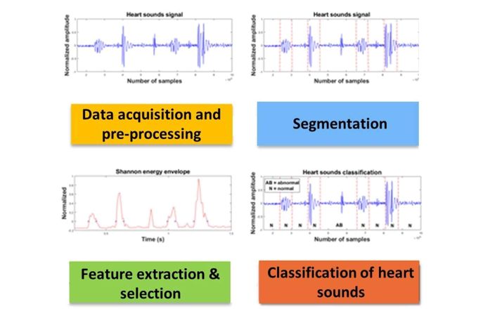 Signal Processing steps for Acousting Signal Sensing