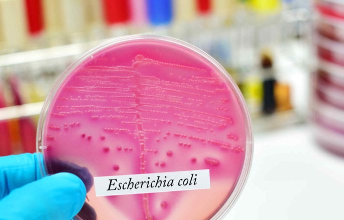E coli in a petri dish