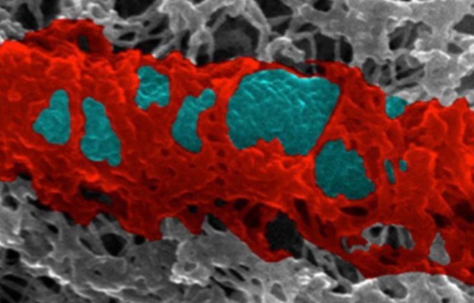 Antimicrobial Research Collaborative