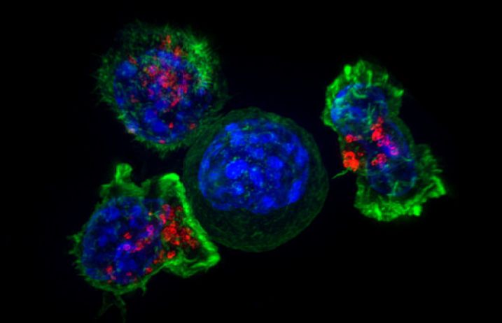 Killer T cells surround a cancer cell