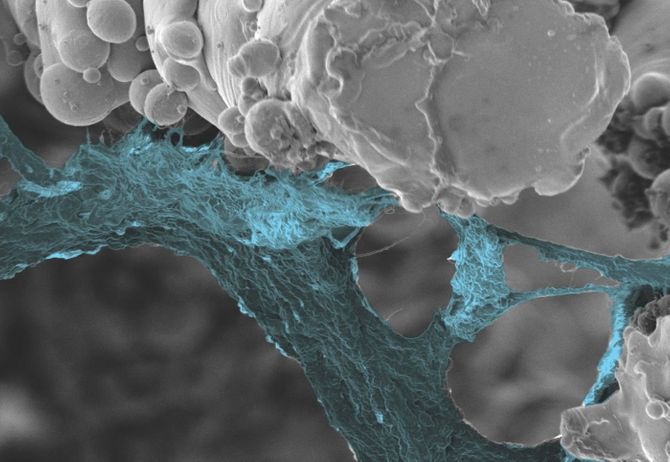 A microscopy view of bone growing around an OSSTEC implant, forming a natural bond