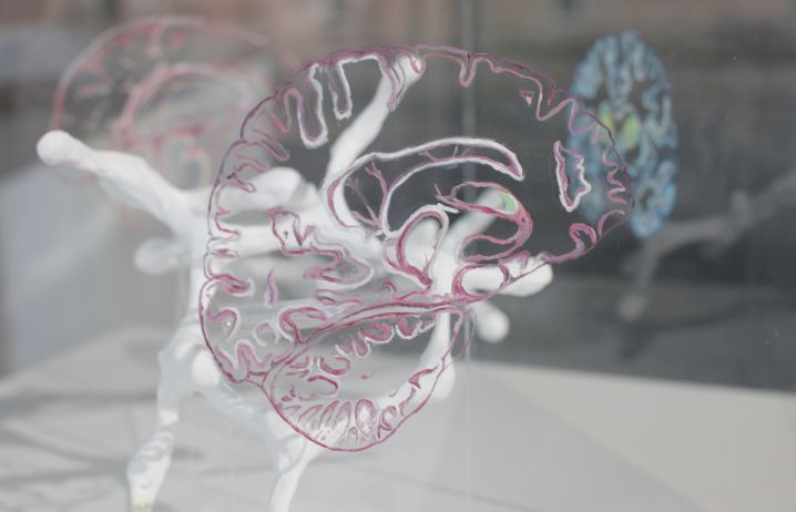 A sculpture showing different parts of the brain