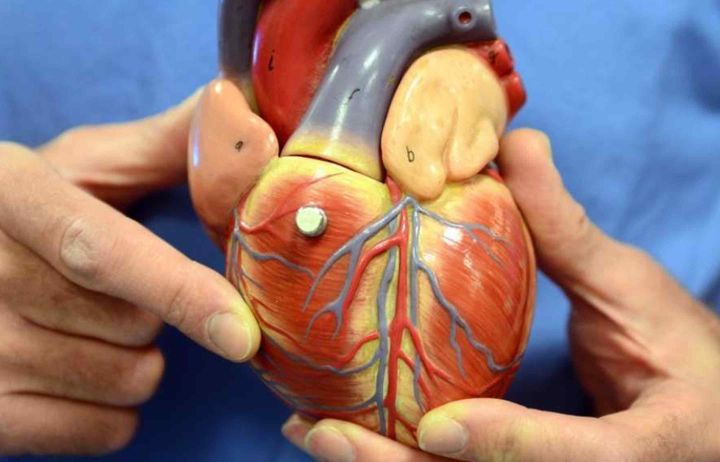 3D heart model