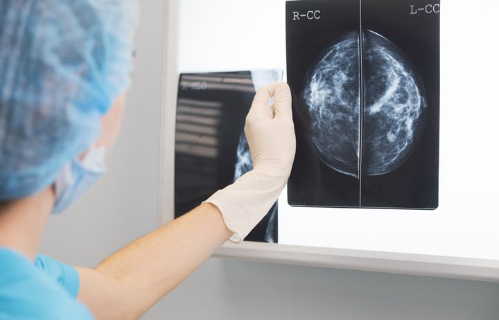 Radiologist looking a mammogram scan