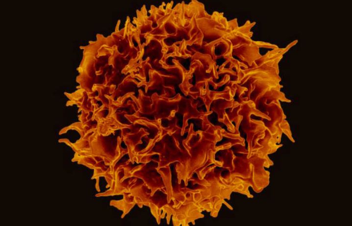 An immune cell
