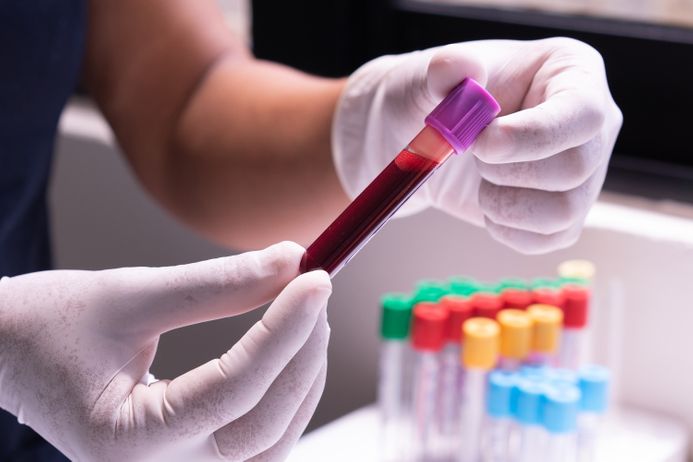 A picture of a blood sample being held in gloved hands. Photo by Los Muertos Crew