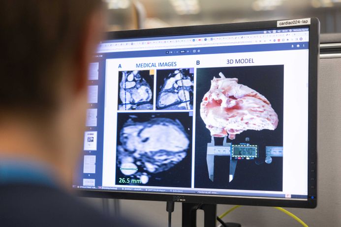 SmartHeart: Developing next-generation cardiovascular imaging techniques for improved diagnosis