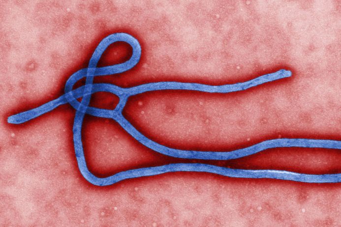 Image of the Ebola virus