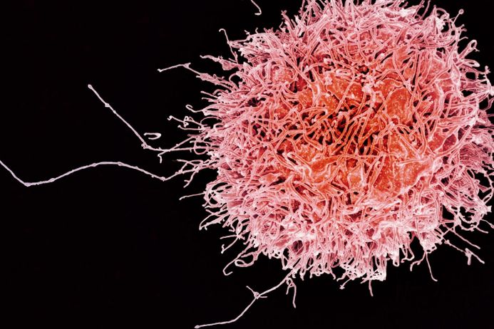 Image of a human natural killer cell