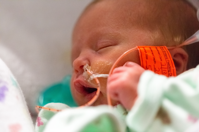 Baby being fed by tube at hospital