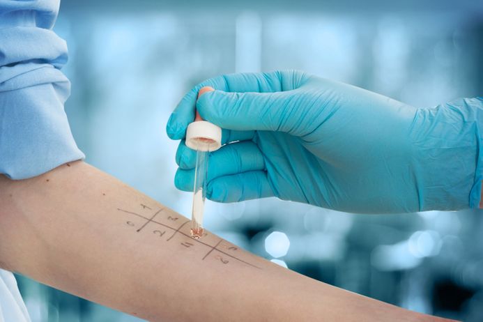 A picture of a patient having an allergy test