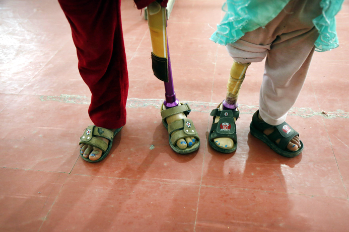 Two children with prosthetic legs