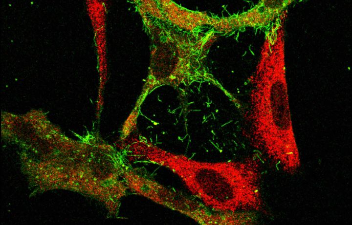 RSV infected epithelial cells