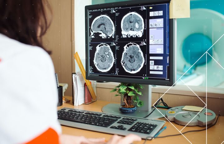 Female doctor looking at MRI scan