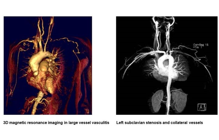 Imaging and serum biomarker discovery