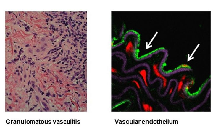 Targeting novel pathogenic pathways