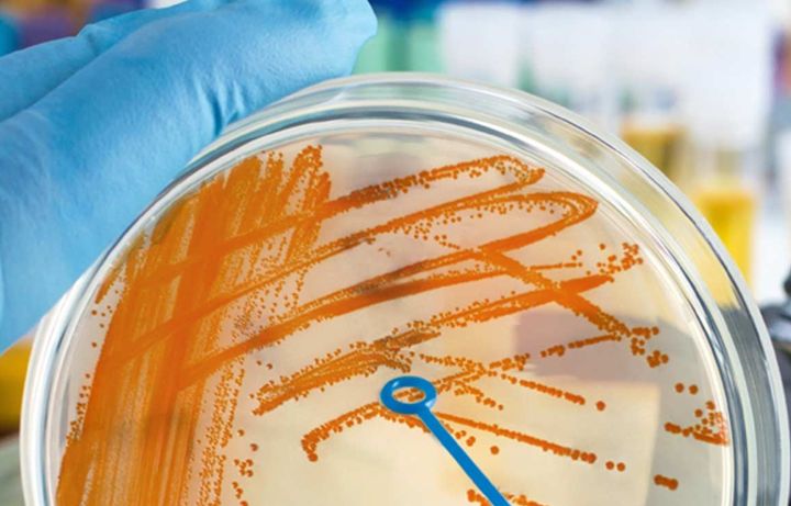 Microbio