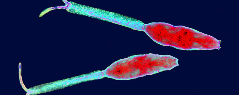 Larval forms of the parasitic worms that cause schistosomiasis