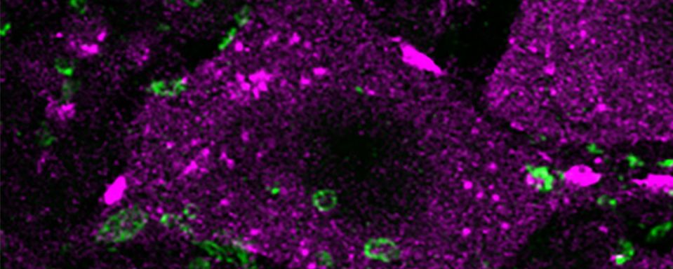 Shown is an increased density of synapses (green) that contact motoneurons (purple) in the spinal cord of an injured animal after treatment with the small molecule TTK21-These are important for motor function.