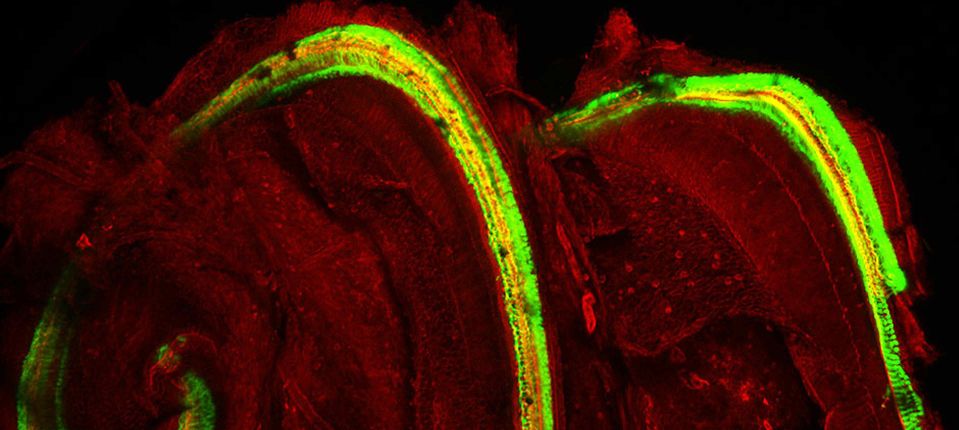 Auditory neuroscience