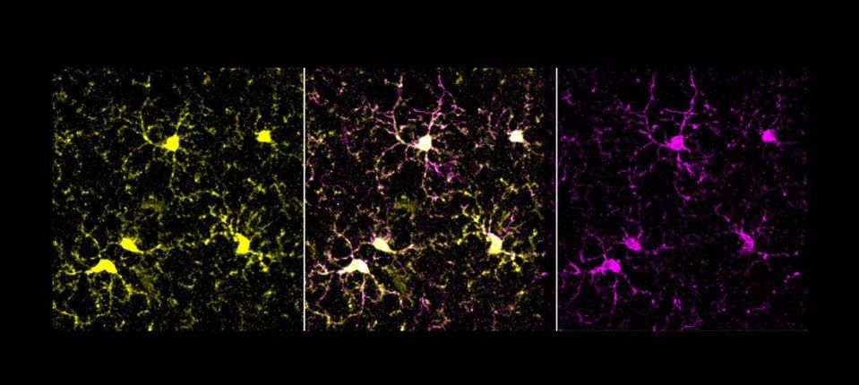 fluorescence imaging