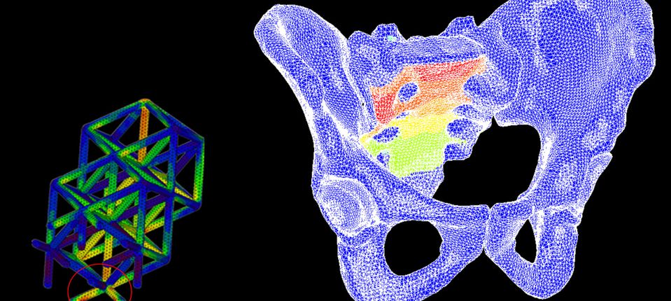 Finite element models