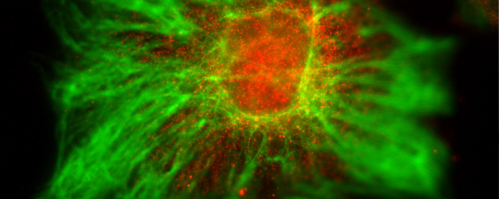 Fluorescent super resolved image of neuronal cells