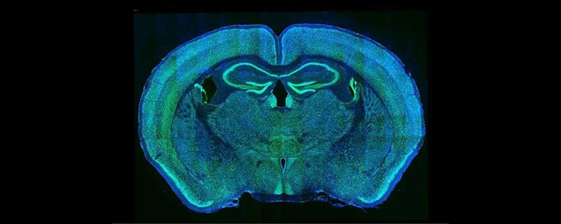 Fluorescent image of mouse brain