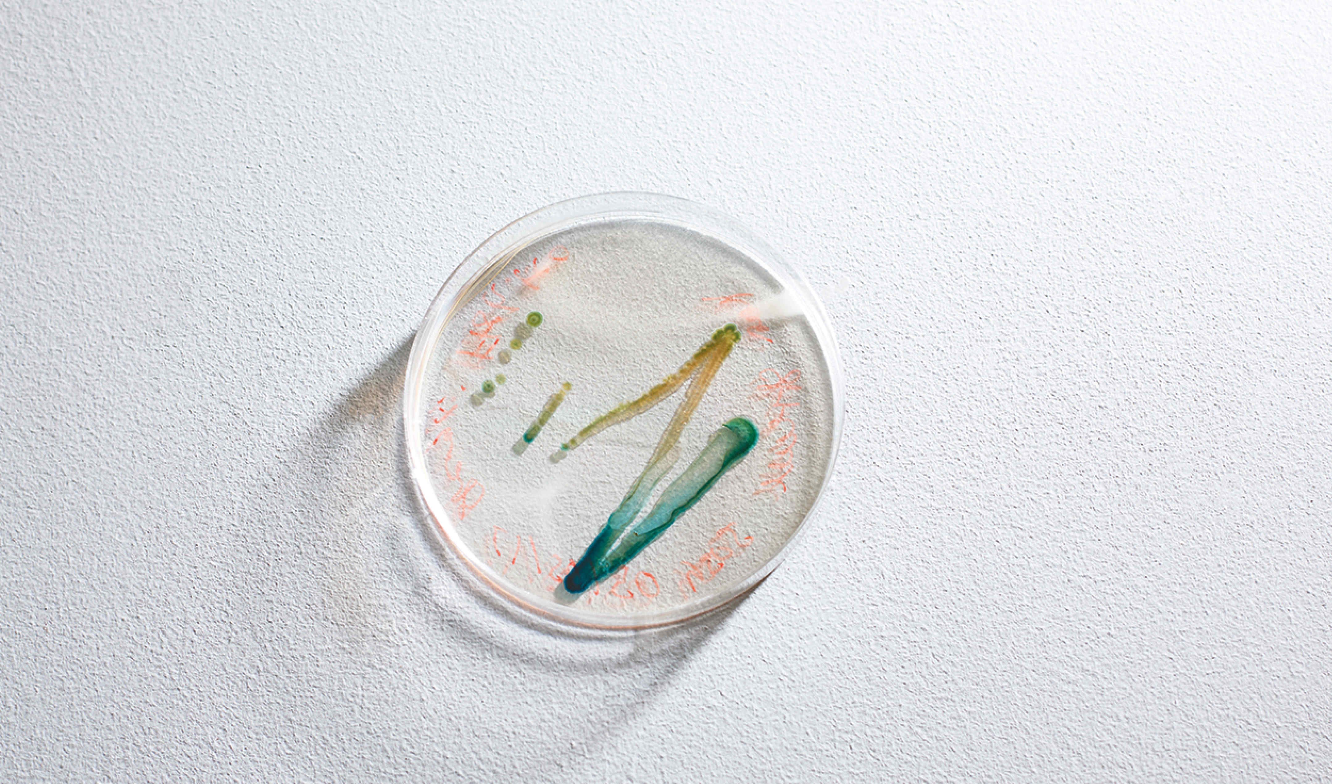 Cyanobacteria on an agar plate used to study the effects of drought and high light on photosynthesis