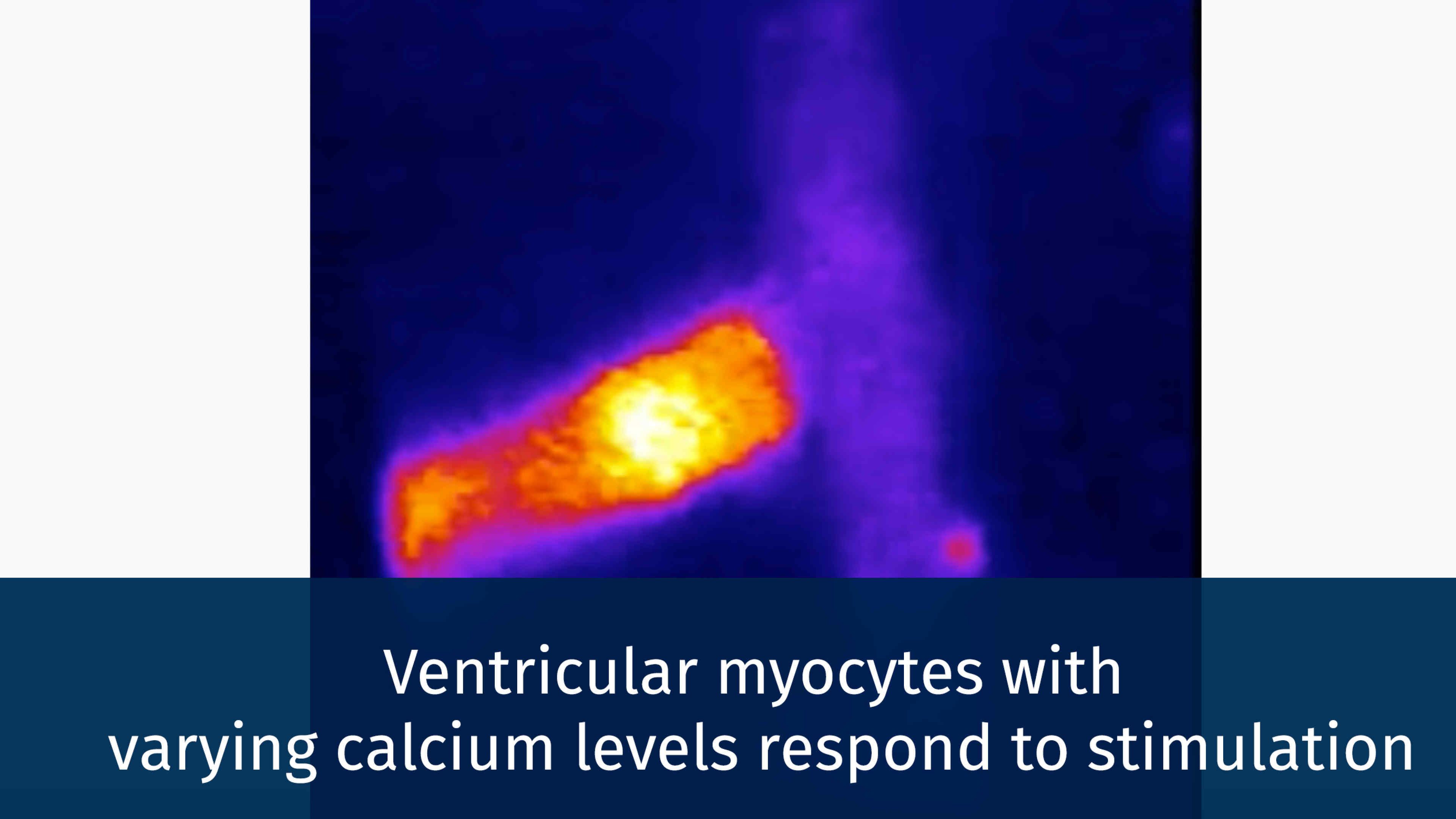 myocyte cell