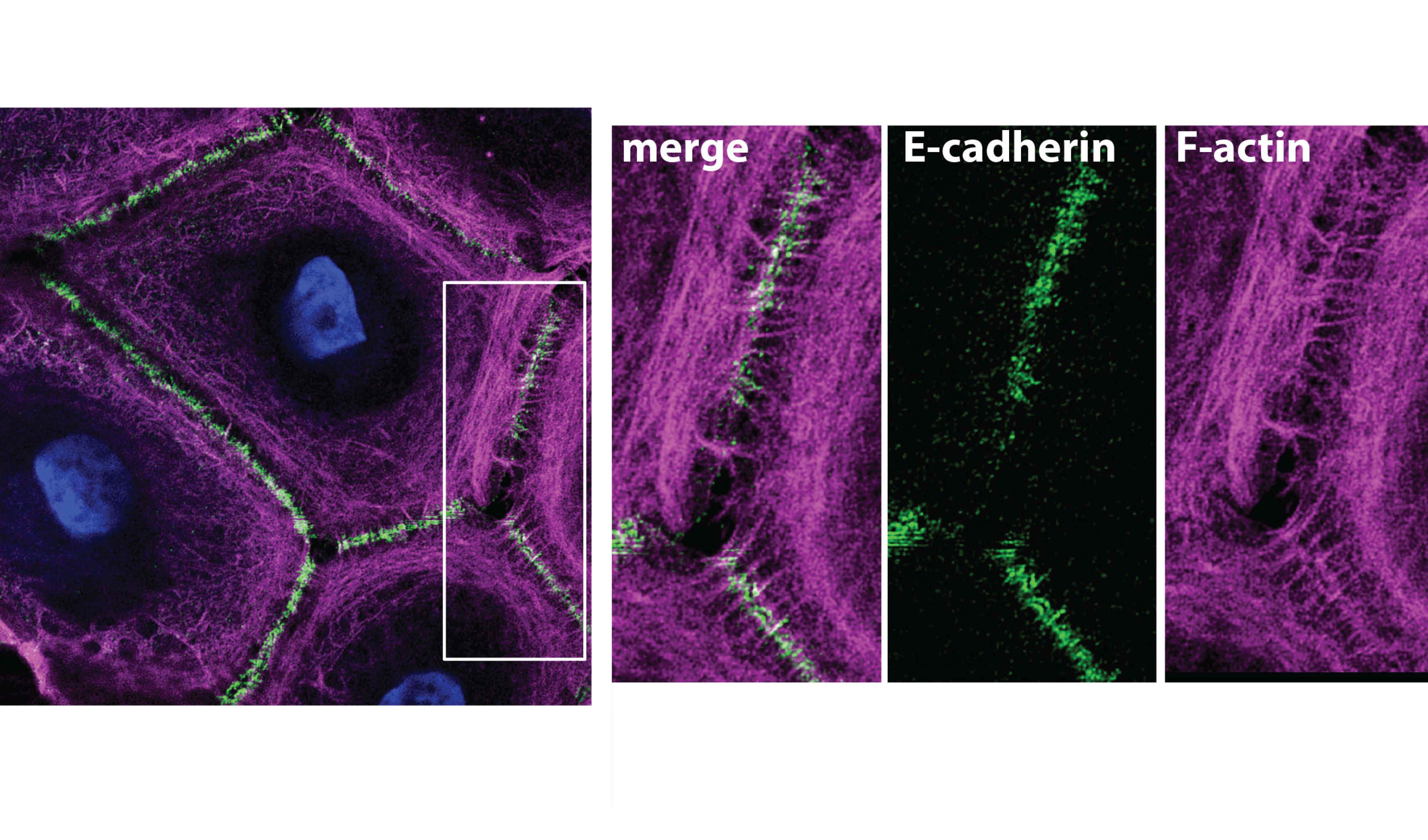 epithelial cells