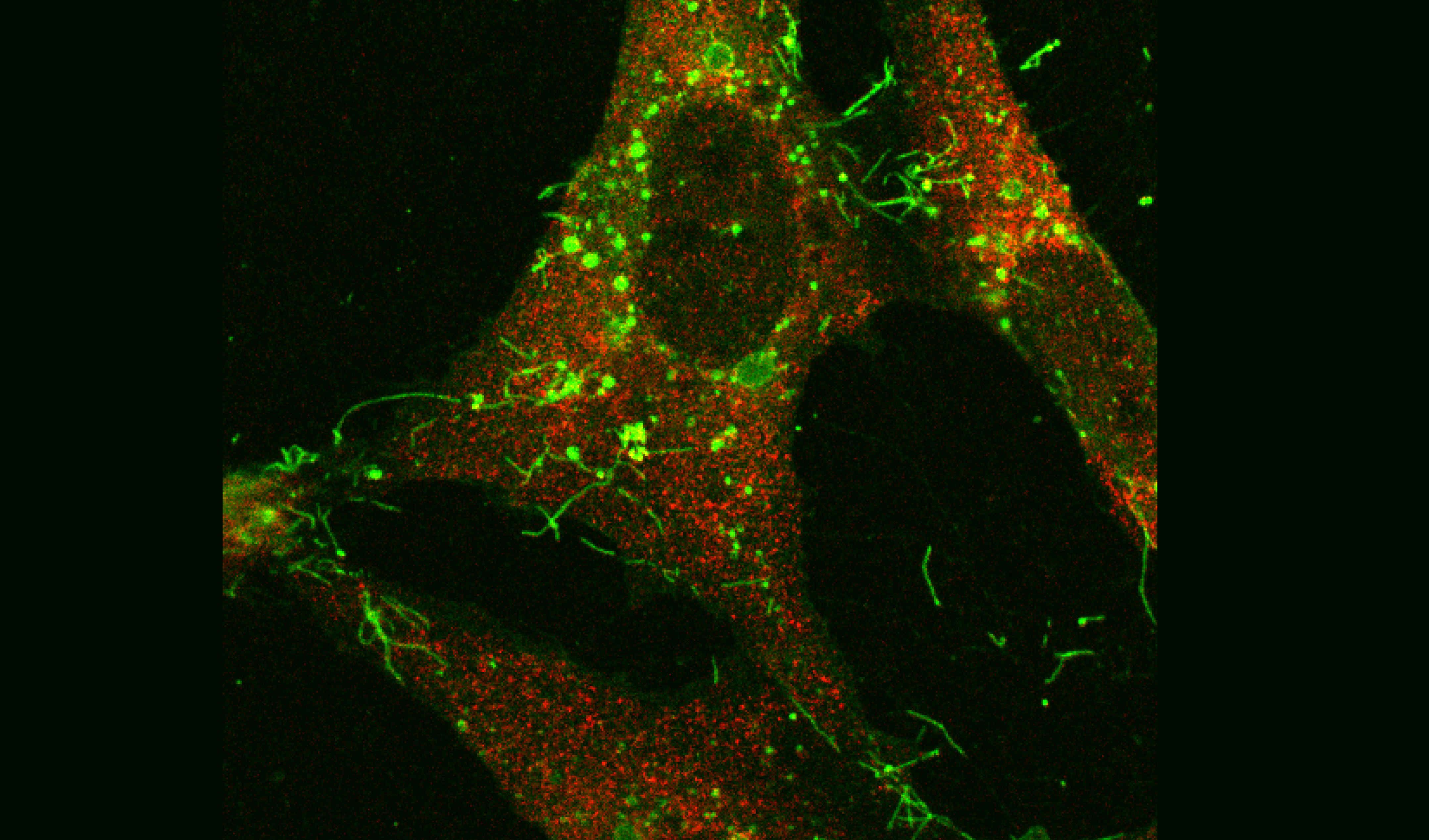 RSV infected epithelial cells