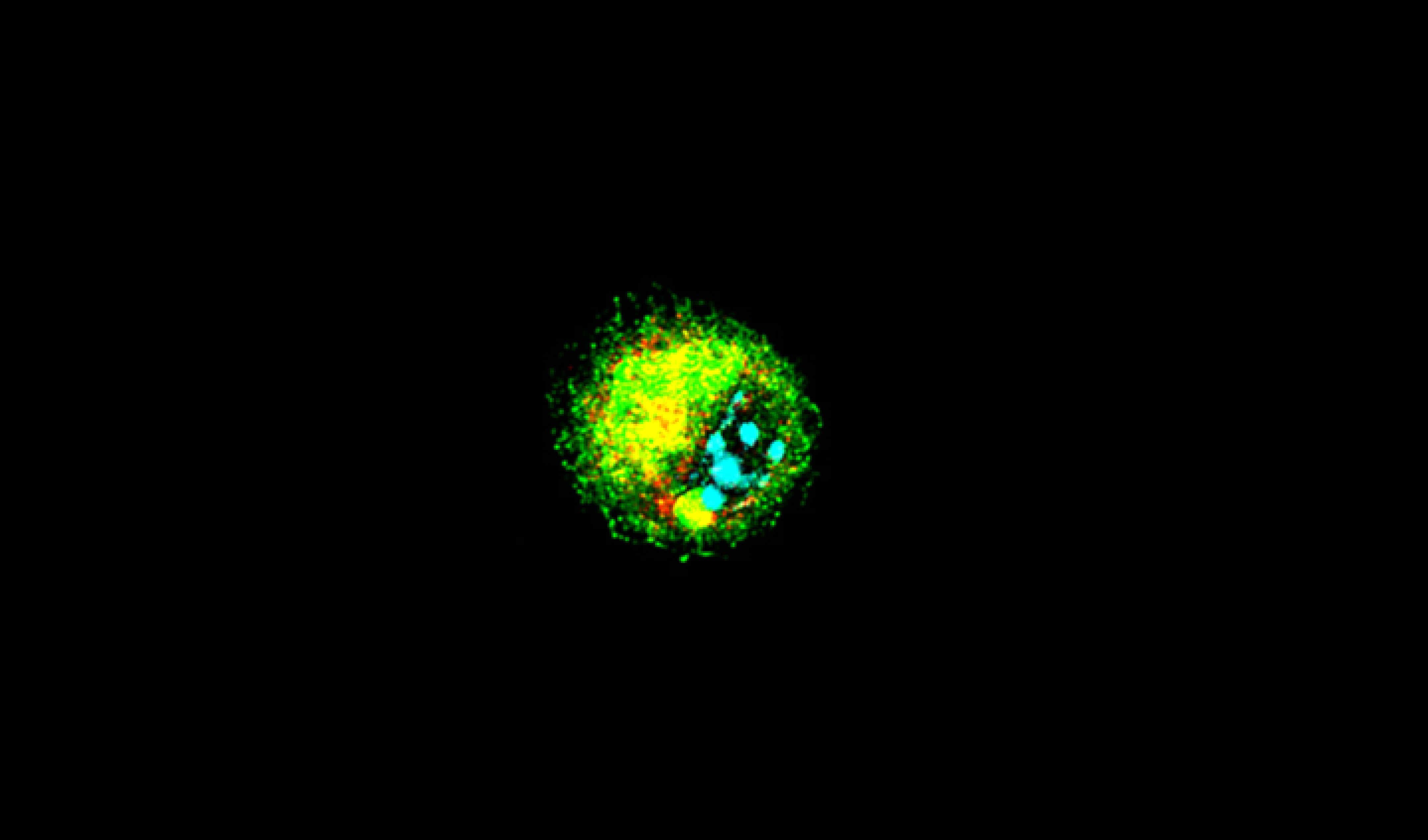 RSV infected alveolar macrophage