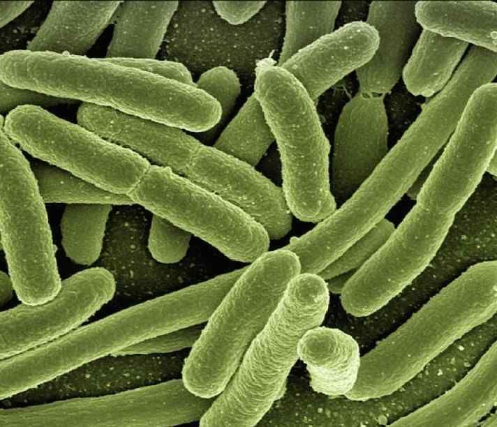 A microscope image of bacteria