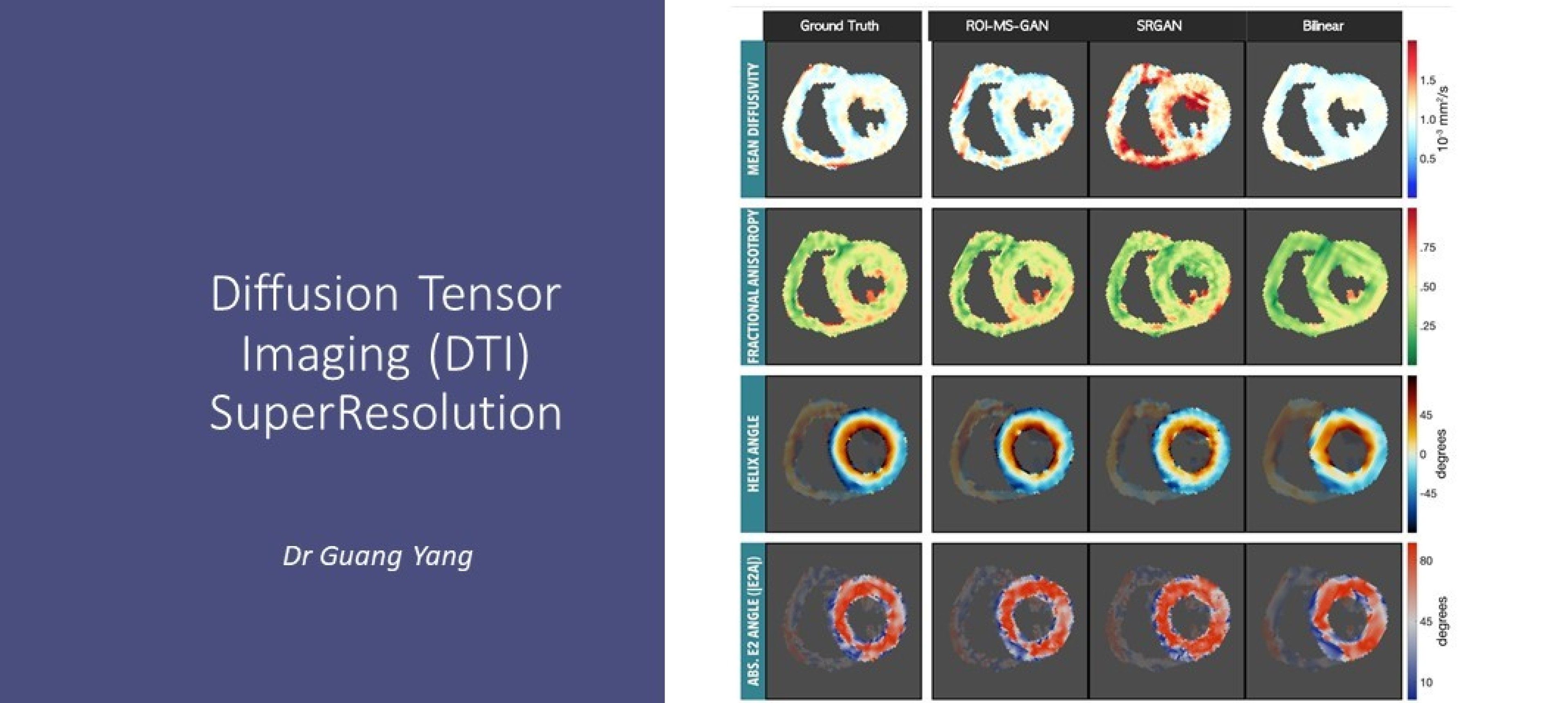 DTI SuperResolution