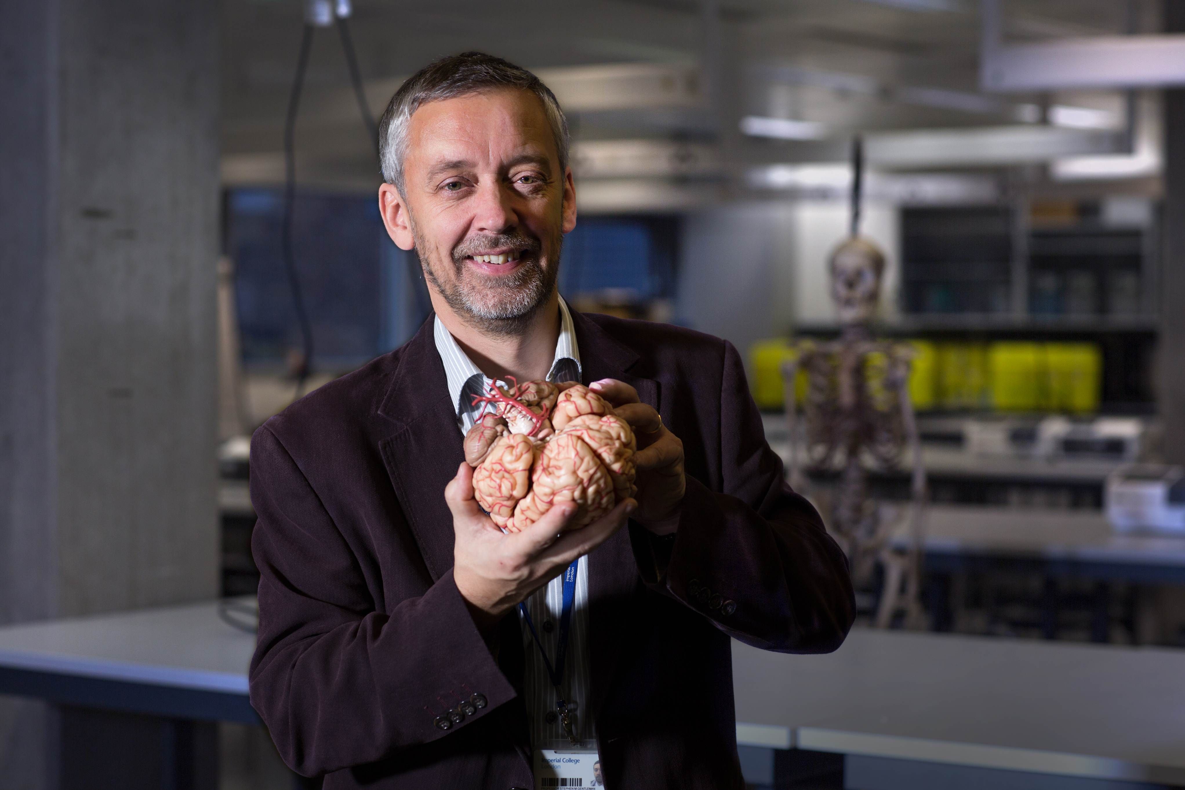 Professor Steve Gentleman holding a brain