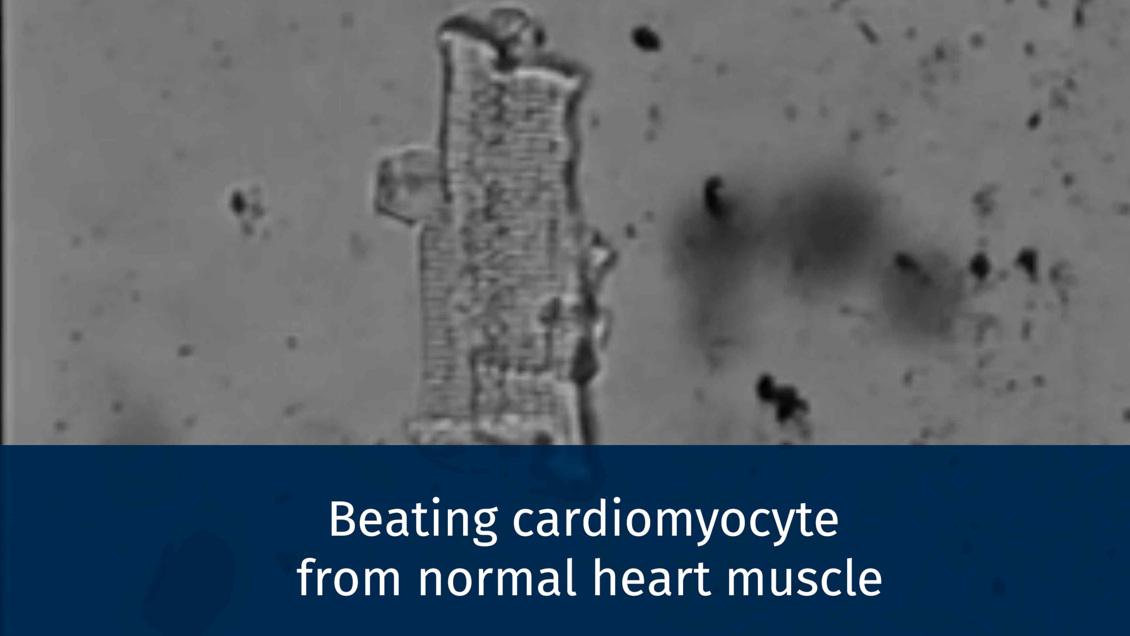 Cardiomyocyte