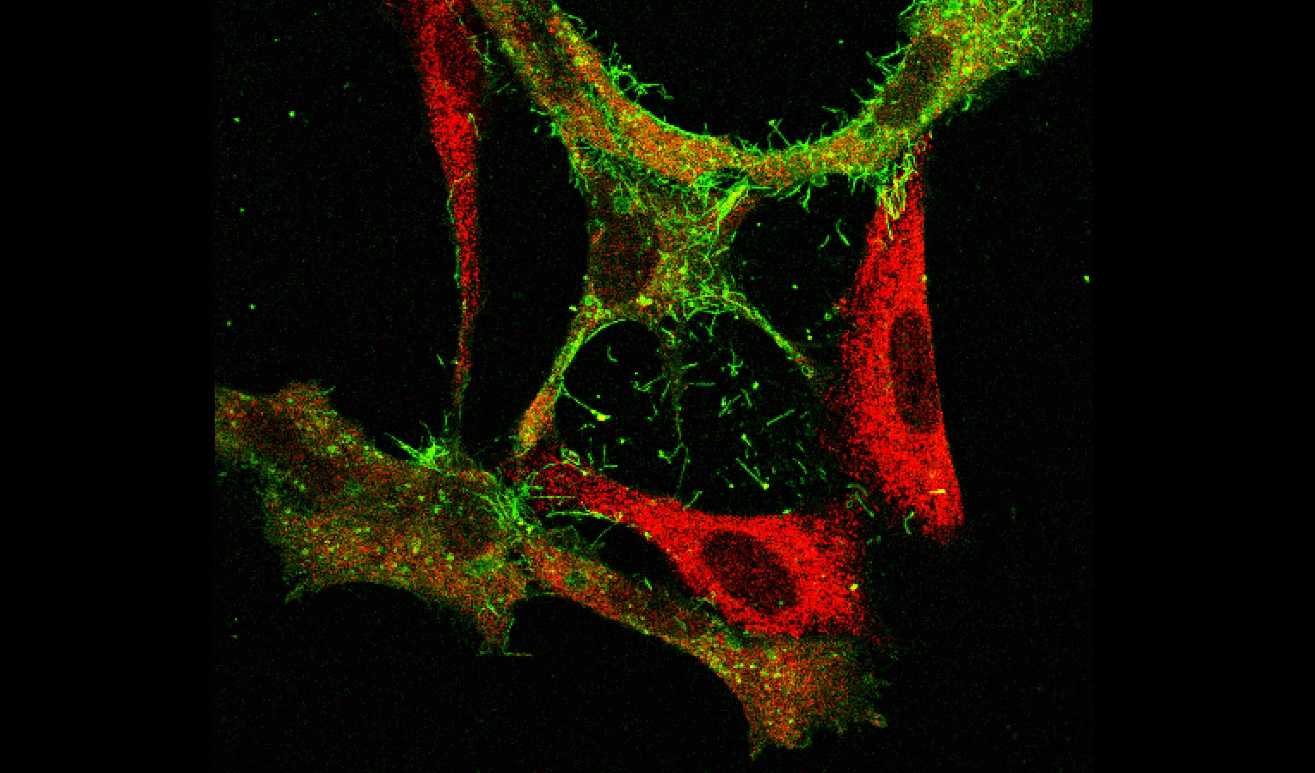 RSV infected epithelial cells