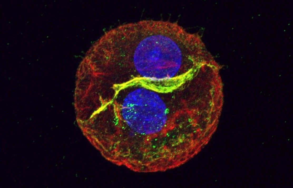 FILM microscopy